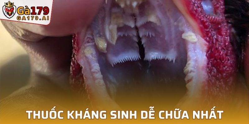 Thuốc kháng sinh dễ chữa nhất